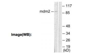 Western Blot: MDM2/HDM2 Antibody [NBP1-67627] - Analysis of lysates from SKOV3 cells, using MDM2 Antibody. The lane on the right is blocked with the synthesized peptide.