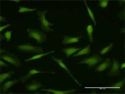 Immunocytochemistry/Immunofluorescence: MDMX Antibody [H00004194-D01P] - Analysis of antibody to MDM4 on HeLa cell. Antibody concentration 10 ug/ml.