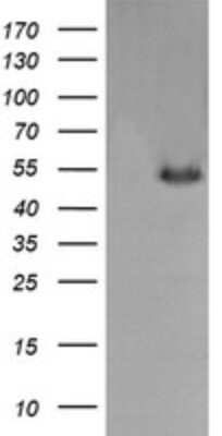 Western Blot: MDMX Antibody (OTI4G5) - Azide and BSA Free [NBP2-72605] - Analysis of HEK293T cells were transfected with the pCMV6-ENTRY control (Left lane) or pCMV6-ENTRY MDMX.