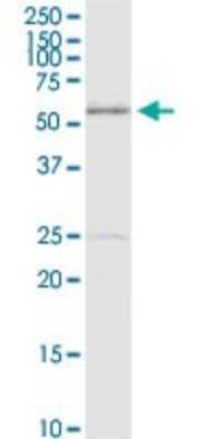Western Blot: MDMX Antibody [H00004194-D01P] - Analysis of MDM4 expression in PC-12.