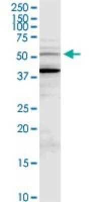 Western Blot: MDMX Antibody [H00004194-D01P] - Analysis of MDM4 expression in MCF-7.