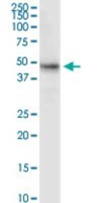 Western Blot: MDMX Antibody [H00004194-D01P] - Analysis of MDM4 expression in human stomach.