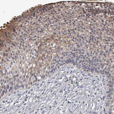 Immunohistochemistry MDN1 Antibody - BSA Free