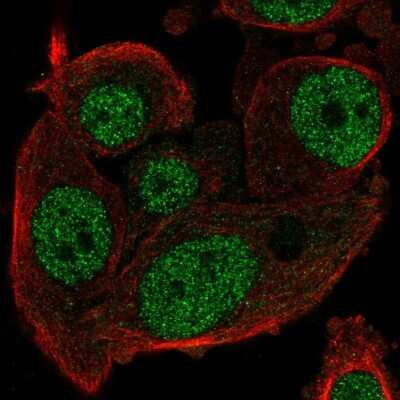 <b>Orthogonal Strategies Validation. </b>Immunocytochemistry/Immunofluorescence: MDP1 Antibody [NBP1-83431] - Staining of human cell line PC-3 shows localization to nucleoplasm.