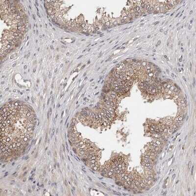 Immunohistochemistry-Paraffin: MDP1 Antibody [NBP1-83431] - Staining of human prostate shows moderate cytoplasmic positivity in glandular cells.