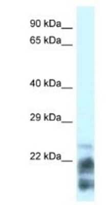 Western Blot MDP1 Antibody - BSA Free