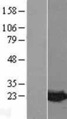 Western Blot: MDP1 Overexpression Lysate (Adult Normal) [NBL1-12972] Left-Empty vector transfected control cell lysate (HEK293 cell lysate); Right -Over-expression Lysate for MDP1.
