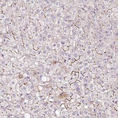 Immunohistochemistry-Paraffin: MDR3/ABCB4 Antibody [NBP2-30887] - Staining of human liver shows strong positivity in bile canaliculi.