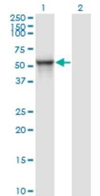 Western Blot: MDS028 Antibody (1A8) [H00055846-M01] - Analysis of ITFG2 expression in transfected 293T cell line by MDS028 monoclonal antibody (M01), clone 1A8.Lane 1: ITFG2 transfected lysate(49.3 KDa).Lane 2: Non-transfected lysate.