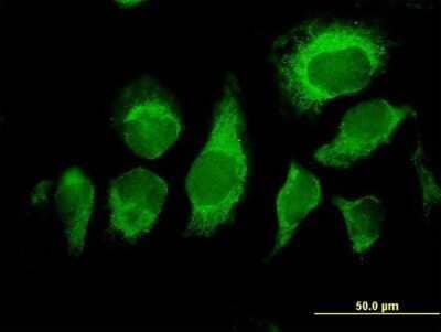 Immunocytochemistry/Immunofluorescence: MDS028 Antibody [H00055846-B01P] - Analysis of purified antibody to MDS028 on HeLa cell. (antibody concentration 10 ug/ml)