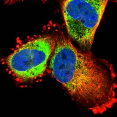 Immunocytochemistry/Immunofluorescence: MDS028 Antibody [NBP1-92103] - Immunofluorescent staining of human cell line U-251 MG shows localization to nucleoplasm & endoplasmic reticulum.