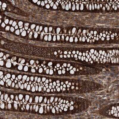 Immunohistochemistry-Paraffin: MDS028 Antibody [NBP1-92103] - Staining of human colon shows strong cytoplasmic positivity in glandular cells.