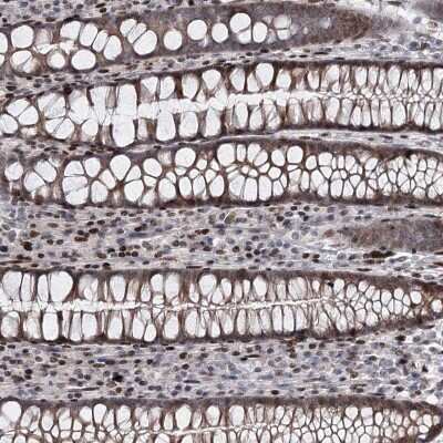 Immunohistochemistry-Paraffin: MDS028 Antibody [NBP2-38424] - Staining of human colon shows nuclear and cytoplasmic positivity in glandular cells.