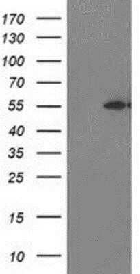 Western Blot MDS028 Antibody (OTI3C4) - Azide and BSA Free