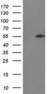 Western Blot: MDS028 Antibody (OTI3C4) [NBP2-00860] - HEK293T cells were transfected with the pCMV6-ENTRY control (Left lane) or pCMV6-ENTRY MDS028 (Right lane) cDNA for 48 hrs and lysed. Equivalent amounts of cell lysates (5 ug per lane) were separated by SDS-PAGE and immunoblotted with anti-MDS028.