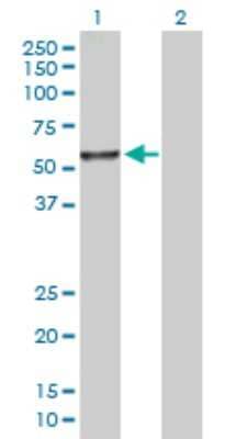 Western Blot: MDS028 Antibody [H00055846-D01P] - Analysis of ITFG2 expression in transfected 293T cell line by ITFG2 polyclonal antibody.Lane 1: ITFG2 transfected lysate(49.30 KDa).Lane 2: Non-transfected lysate.
