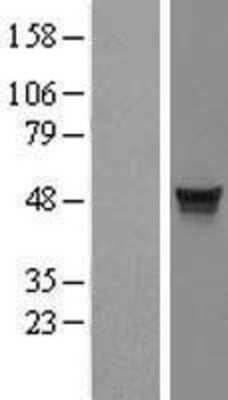 Western Blot: MDS028 Overexpression Lysate (Adult Normal) [NBL1-12059] Left-Empty vector transfected control cell lysate (HEK293 cell lysate); Right -Over-expression Lysate for MDS028.