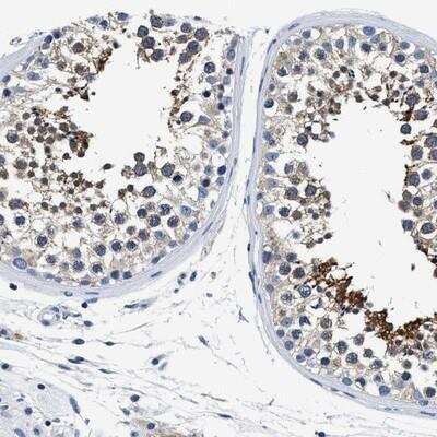 Immunohistochemistry-Paraffin: MEA-1 Antibody [NBP1-81245] - Staining of human testis shows cytoplasmic positivity in seminiferus ducts.