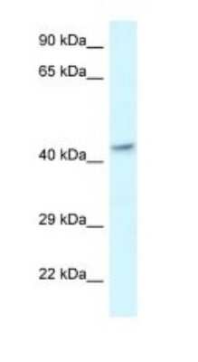 Western Blot: MECR Antibody [NBP1-79910] - Titration: 1.0 ug/ml Positive Control: Fetal Brain.