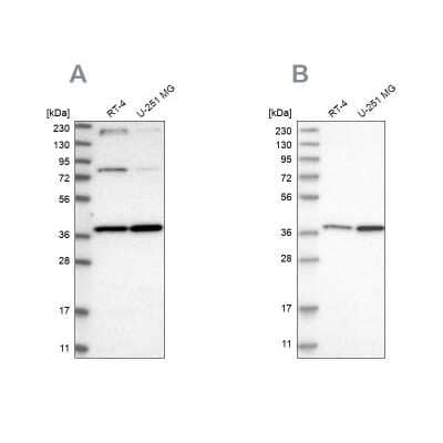 Western Blot MECR Antibody - BSA Free