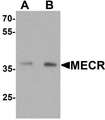 Western Blot: MECR Antibody [NBP2-81846] - Western blot analysis of MECR in human brain tissue lysate with MECR antibody at (A) 1 and (B) 2 ug/mL.