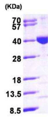 Western Blot Recombinant Human MECR His Protein