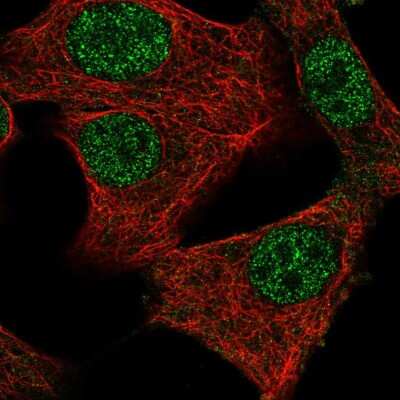 Immunocytochemistry/ Immunofluorescence MED11 Antibody