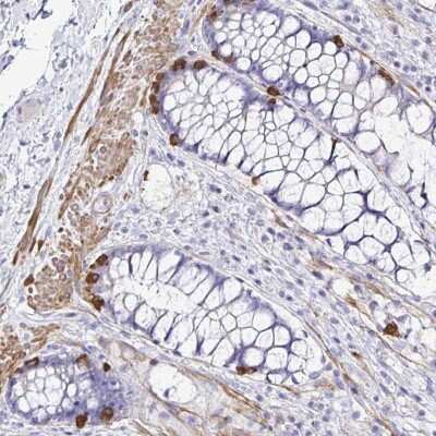 Immunohistochemistry-Paraffin MED11 Antibody