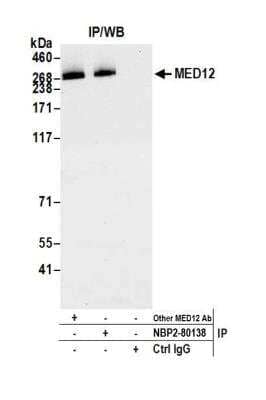 Immunoprecipitation: MED12 Antibody (BLR084G) [NBP2-80138] - Detection of human MED12 by WB of immunoprecipitates from HeLa lysate. Antibodies: Rabbit anti-MED12 recombinant monoclonal [BLR084G] (NBP2-80138) and another rabbit anti-MED12 antibody.