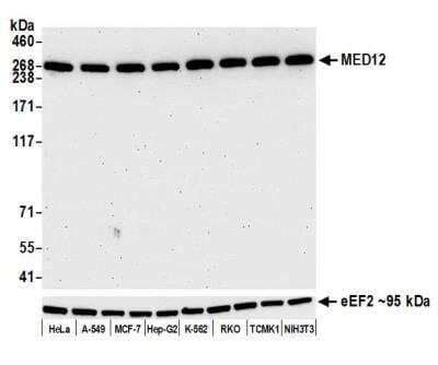 Western Blot: MED12 Antibody (BLR084G) [NBP2-80138] - Detection of human and mouse MED12 by WB of HeLa, A-549, MCF-7, Hep-G2, K-562, RKO, TCMK-1, and NIH 3T3 lysate. Antibody: Rabbit anti-MED12 recombinant monoclonal [BLR084G] (NBP2-80138). Secondary: HRP-conjugated goat anti-rabbit IgG. Lower Panel: Rabbit anti-eEF2.
