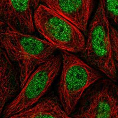 Immunocytochemistry/Immunofluorescence: MED14 Antibody [NBP2-56318] - Staining of human cell line SiHa shows localization to nucleoplasm.