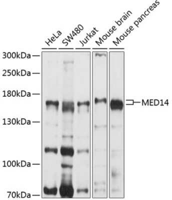 Western Blot: MED14 Antibody [NBP3-05055] - Analysis of extracts of various cell lines, using MED14 antibody at 1:1000 dilution. Secondary antibody: HRP Goat Anti-Rabbit IgG (H+L) at 1:10000 dilution. Lysates/proteins: 25ug per lane. Blocking buffer: 3% nonfat dry milk in TBST. Detection: ECL Basic Kit