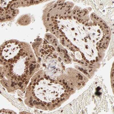 Immunohistochemistry-Paraffin: MED15 Antibody [NBP1-89018] - Staining of human placenta shows strong nuclear and cytoplasmic positivity in trophoblastic cells.