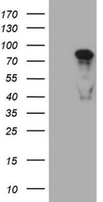 Western Blot: MED15 Antibody (OTI1C11) - Azide and BSA Free [NBP2-72618] - Analysis of HEK293T cells were transfected with the pCMV6-ENTRY control (Left lane) or pCMV6-ENTRY MED15.