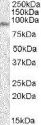 Western Blot: MED15 Antibody [NBP1-28800] - (1ug/ml) staining of Human Lung lysate (35ug protein in RIPA buffer). Primary incubation was 1 hour. Detected by chemiluminescence.