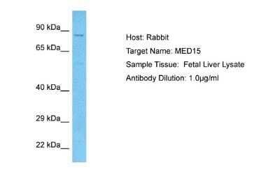 Western Blot: MED15 Antibody [NBP2-37851] - Fetal Liver lysates, Antibody Dilution: 1.0 ug/ml.