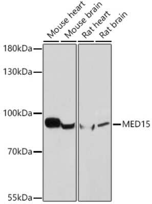 Western Blot: MED15 Antibody [NBP3-15565] - Western blot analysis of extracts of various cell lines, using MED15 antibody (NBP3-15565) at 1:1000 dilution. Secondary antibody: HRP Goat Anti-Rabbit IgG (H+L) at 1:10000 dilution. Lysates/proteins: 25ug per lane. Blocking buffer: 3% nonfat dry milk in TBST. Detection: ECL Basic Kit. Exposure time: 10s.