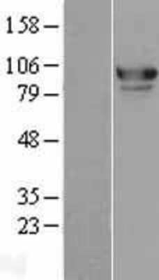 Western Blot: MED15 Overexpression Lysate (Adult Normal) [NBL1-12981] Left-Empty vector transfected control cell lysate (HEK293 cell lysate); Right -Over-expression Lysate for MED15.