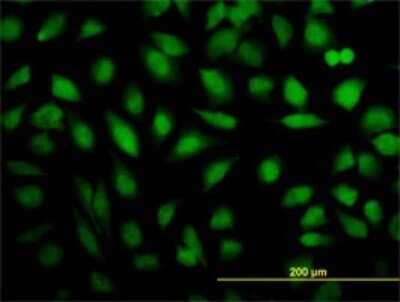 Immunocytochemistry/Immunofluorescence: MED16 Antibody (2B7) [H00010025-M02] - Analysis of monoclonal antibody to THRAP5 on HeLa cell. Antibody concentration 10 ug/ml.