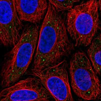 Immunocytochemistry/Immunofluorescence: MED17 Antibody [NBP2-57476] - Staining of human cell line SiHa shows localization to vesicles.