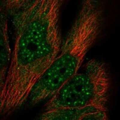 Immunocytochemistry/Immunofluorescence: MED17 Antibody [NBP3-17737] - Staining of human cell line EFO-21 shows localization to nuclear speckles & cytosol.