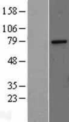 Western Blot: MED17 Overexpression Lysate (Adult Normal) [NBL1-12982] Left-Empty vector transfected control cell lysate (HEK293 cell lysate); Right -Over-expression Lysate for MED17.