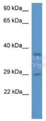 Western Blot: MED19 Antibody [NBP1-79597] - Rat Liver Lysate, probed with MED19 Antibody, diluted at 1 ug/ml.