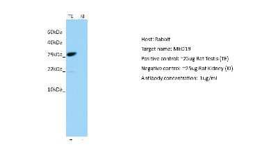 Western Blot: MED19 Antibody [NBP2-87792] - Host: Rabbit. Target: MED19. Positive control (+): Rat testis (R-TE). Negative control (-): Rat kidney (R-KI). Antibody concentration: 1ug/ml