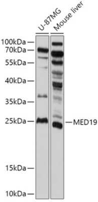 Western Blot: MED19 Antibody [NBP3-05123] - Analysis of extracts of various cell lines, using MED19 antibody at 1:1000 dilution. Secondary antibody: HRP Goat Anti-Rabbit IgG (H+L) at 1:10000 dilution. Lysates/proteins: 25ug per lane. Blocking buffer: 3% nonfat dry milk in TBST. Detection: ECL Basic Kit