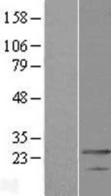 Western Blot MED19 Overexpression Lysate