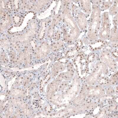 Immunohistochemistry-Paraffin MED20 Antibody