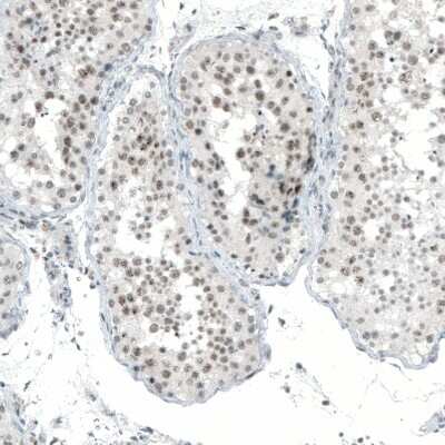 Immunohistochemistry-Paraffin: MED20 Antibody [NBP1-84140] - Staining of human testis shows moderate nuclear positivity in cells in seminiferous ducts.