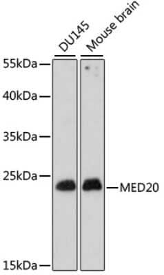 Western Blot: MED20 Antibody [NBP3-04528] - Analysis of extracts of various cell lines, using MED20 antibody at 1:1000 dilution. Secondary antibody: HRP Goat Anti-Rabbit IgG (H+L) at 1:10000 dilution. Lysates/proteins: 25ug per lane. Blocking buffer: 3% nonfat dry milk in TBST. Detection: ECL Basic Kit