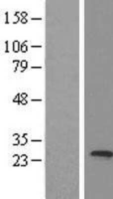 Western Blot: MED20 Overexpression Lysate (Adult Normal) [NBL1-12985] Left-Empty vector transfected control cell lysate (HEK293 cell lysate); Right -Over-expression Lysate for MED20.